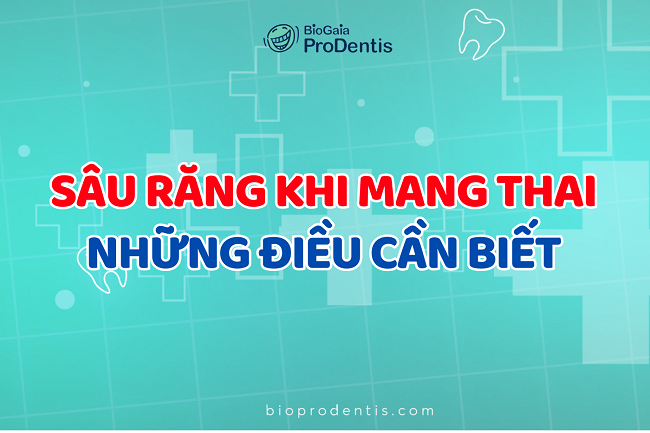 Sâu răng khi mang thai và những điều cần biết